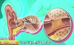 冷知識(shí):正常人無需掏耳朵,越掏越栓塞