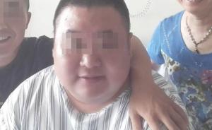 安徽一体重160公斤交警“缩胃减重”，在南京做手术后死亡