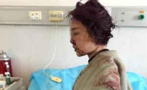 “女子丽江被打毁容”案或于本月内开庭，6名被告人表达歉意