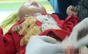 重庆1岁4个月男童被自家小狗咬掉生殖器，已接受首次手术