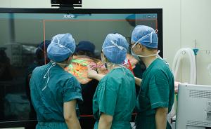 上海医生成功分离肝脏连体女婴：切断血管，再造脐部