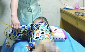 合肥4岁男童遍体鳞伤医院一度下病危通知，警方已介入调查