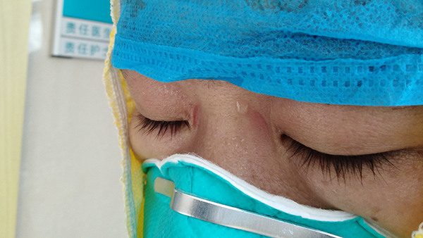 护士满脸压痕，69岁新冠肺炎患者哽咽