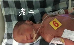 四川宜宾早产三胞胎被下达病危通知，26岁农民父亲网络筹款