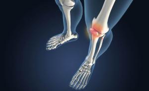 关节炎日｜膝关节炎防治要“动起来”，运动不对反伤膝盖