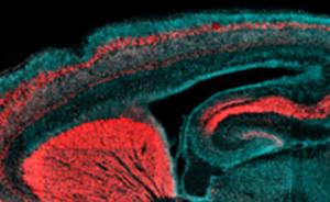 中科院生物物理所等揭示人类大脑皮层沟回折叠新机制