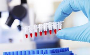 欧美研发新型血液检测法：能诊断多种早期癌症，准确率62%