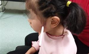 疼！5岁女童摔倒铅笔插入脸颊4厘米，医生提醒：勿自行拔出