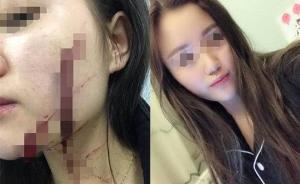 18岁女孩称被合租女生带回的男生砍毁容，警方：仍在调查中