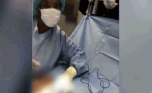 美国医生爱上自拍，手术中拍恶搞视频