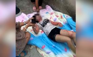 少女被開水灌喉,嫌犯疑為母親“情敵”