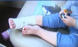 杭州一小孩左脚骨折却包扎右脚，涉事医生：孩子太小没拍片