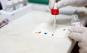 新型HIV疫苗开始第二阶段临床疗效试验：引起较强免疫反应