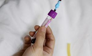 耶鲁大学开发新测试：验血测寿命