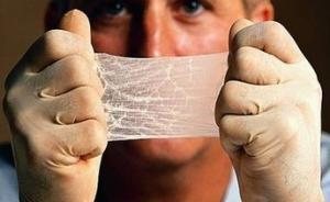 科学家用蛛丝和蚕丝制成人造皮肤，有望用于移植手术