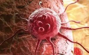 美国开发磁力装置：能捕获血液中肿瘤细胞，快速发现早期癌症