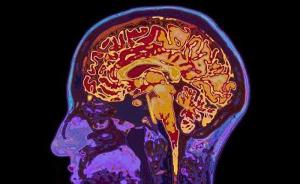 “迷你大脑”首次具备髓鞘生成功能，可研究脊髓损伤等疾病