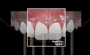 顶级牙医是如何修复烂牙的？